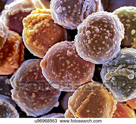 Staphylococcus bacteria, coloured scanning electron micrograph (SEM). Staphylococcus bacteria are an example of cocci (round bacteria). They form grape-like clusters. View Large Illustration Drawing - Staphylococcus bacteria, coloured scanning electron micrograph (SEM). Staphylococcus bacteria are an example of cocci (round bacteria). They form grape-like clusters.. Fotosearch