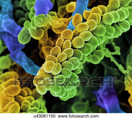Streptococcus bacteria. Coloured scanning electron micrograph (SEM) of chains of Streptococcus bacteria with Streptomyces coelicoflavus bacteria in the background. Streptococcus bacteria are an example of cocci (round bacteria) that form chains. View Large Illustration Clipart - Streptococcus bacteria. Coloured scanning electron micrograph (SEM) of chains of Streptococcus bacteria with Streptomyces coelicoflavus bacteria in the background. Streptococcus bacteria are an example of cocci (round bacteria) that form chains.. Fotosearch