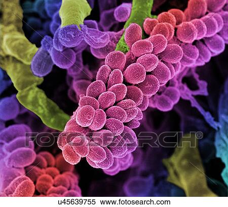 Stock Illustration - Streptococcus bacteria. Coloured scanning electron micrograph (SEM) of chains of Streptococcus bacteria with Streptomyces coelicoflavus bacteria in the background. Streptococcus bacteria are an example of cocci (round bacteria) that form chains.. Fotosearch