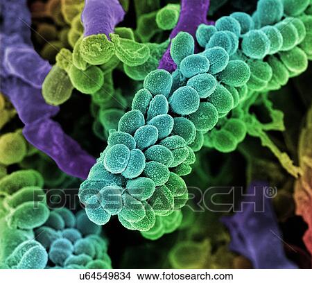 Streptococcus bacteria. Coloured scanning electron micrograph (SEM) of chains of Streptococcus bacteria with Streptomyces coelicoflavus bacteria in the background. Streptococcus bacteria are an example of cocci (round bacteria) that form chains. View Large Illustration Stock Illustration - Streptococcus bacteria. Coloured scanning electron micrograph (SEM) of chains of Streptococcus bacteria with Streptomyces coelicoflavus bacteria in the background. Streptococcus bacteria are an example of cocci (round bacteria) that form chains.. Fotosearch
