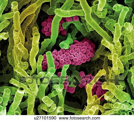 Clipart - Streptomyces coelicoflavus bacteria. Coloured scanning electron micrograph (SEM) of Streptomyces coelicoflavus bacteria (strands) and chains of Streptococcus bacteria (round).. Fotosearch