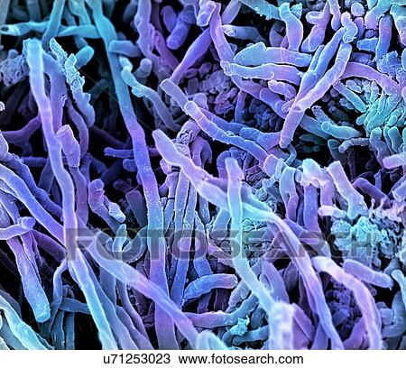 Drawing - Streptomyces coelicoflavus bacteria. Coloured scanning electron micrograph (SEM) of strands of Streptomyces coelicoflavus bacteria. Streptomyces coelicoflavus is a filamentous soil bacterium.. Fotosearch