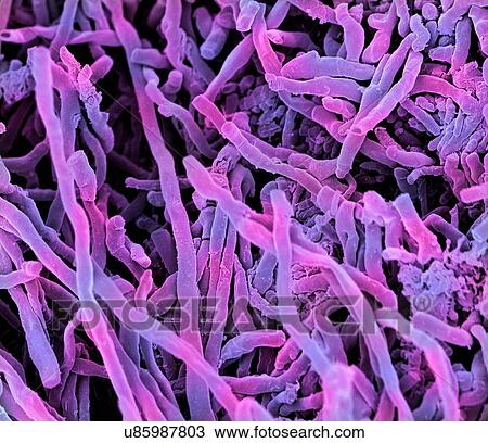 Drawing - Streptomyces coelicoflavus bacteria. Coloured scanning electron micrograph (SEM) of strands of Streptomyces coelicoflavus bacteria. Streptomyces coelicoflavus is a filamentous soil bacterium.. Fotosearch