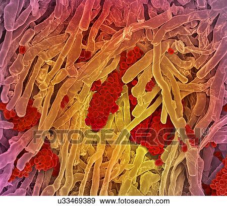 Stock Illustration - Streptomyces coelicoflavus bacteria. Coloured scanning electron micrograph (SEM) of Streptomyces coelicoflavus bacteria (strands) and chains of Streptococcus bacteria (round).. Fotosearch