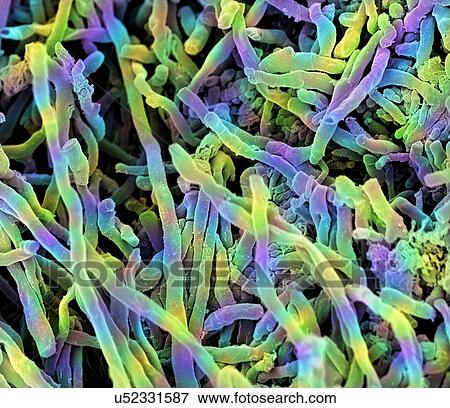 Stock Illustration - Streptomyces coelicoflavus bacteria. Coloured scanning electron micrograph (SEM) of strands of Streptomyces coelicoflavus bacteria. Streptomyces coelicoflavus is a filamentous soil bacterium.. Fotosearch