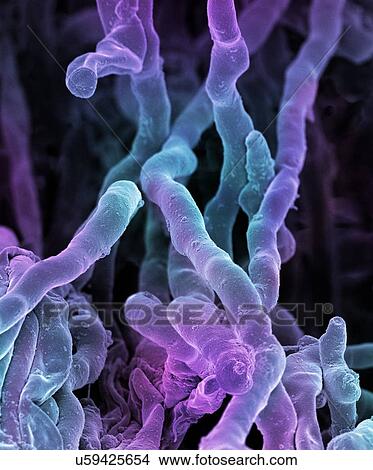 Stock Illustration - Streptomyces coelicoflavus bacteria. Coloured scanning electron micrograph (SEM) of strands of Streptomyces coelicoflavus bacteria. Streptomyces coelicoflavus is a filamentous soil bacterium.. Fotosearch