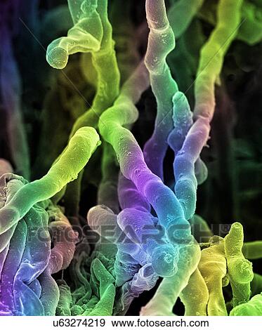 Stock Illustration - Streptomyces coelicoflavus bacteria. Coloured scanning electron micrograph (SEM) of strands of Streptomyces coelicoflavus bacteria. Streptomyces coelicoflavus is a filamentous soil bacterium.. Fotosearch