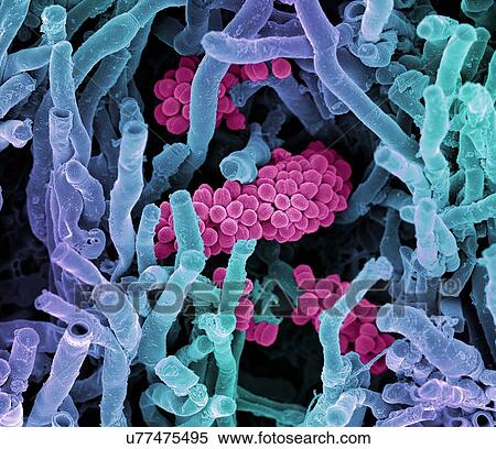 Streptomyces coelicoflavus bacteria. Coloured scanning electron micrograph (SEM) of Streptomyces coelicoflavus bacteria (strands) and chains of Streptococcus bacteria (round). View Large Illustration Stock Illustration - Streptomyces coelicoflavus bacteria. Coloured scanning electron micrograph (SEM) of Streptomyces coelicoflavus bacteria (strands) and chains of Streptococcus bacteria (round).. Fotosearch