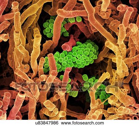 Streptomyces coelicoflavus bacteria. Coloured scanning electron micrograph (SEM) of Streptomyces coelicoflavus bacteria (strands) and chains of Streptococcus bacteria (round). View Large Illustration Stock Illustration - Streptomyces coelicoflavus bacteria. Coloured scanning electron micrograph (SEM) of Streptomyces coelicoflavus bacteria (strands) and chains of Streptococcus bacteria (round).. Fotosearch