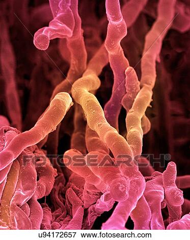 Streptomyces coelicoflavus bacteria. Coloured scanning electron micrograph (SEM) of strands of Streptomyces coelicoflavus bacteria. Streptomyces coelicoflavus is a filamentous soil bacterium. View Large Illustration Stock Illustration - Streptomyces coelicoflavus bacteria. Coloured scanning electron micrograph (SEM) of strands of Streptomyces coelicoflavus bacteria. Streptomyces coelicoflavus is a filamentous soil bacterium.. Fotosearch