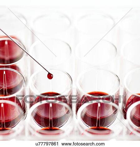 Syringe dripping blood sample into a multiwell tray. View Large Illustration Clip Art - Syringe dripping blood sample into a multiwell tray.. Fotosearch