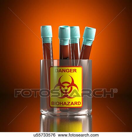 Test tube with contaminated blood, illustration, View Large Illustration Stock Illustration - Test tube with contaminated blood, illustration,. Fotosearch