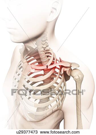 Drawing - "Broken collar bone, Illustration". Fotosearch