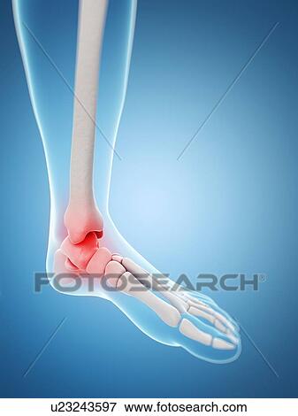 "Human ankle pain, Illustration" View Large Illustration Stock Illustration - "Human ankle pain, Illustration". Fotosearch