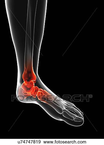 "Human ankle pain, Illustration" View Large Illustration Stock Illustration - "Human ankle pain, Illustration". Fotosearch