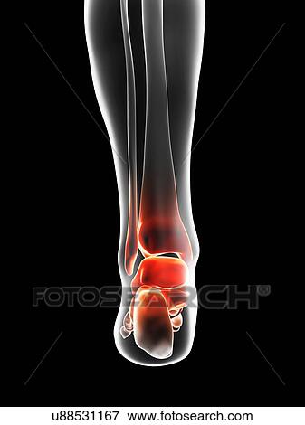 "Human ankle pain, Illustration" View Large Illustration Stock Illustration - "Human ankle pain, Illustration". Fotosearch