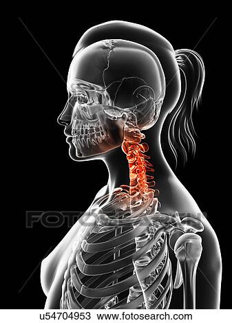 Drawing - "Human cervical spine pain, Illustration". Fotosearch