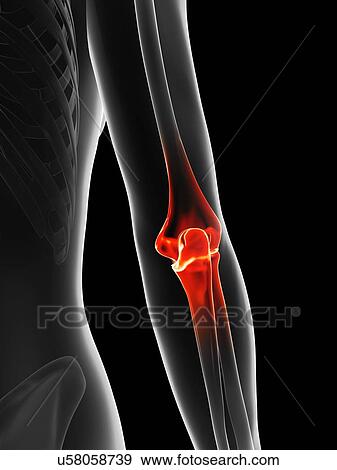 Stock Illustration - "Human elbow pain, Illustration". Fotosearch