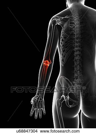 "Human elbow pain, Illustration" View Large Illustration Stock Illustration - "Human elbow pain, Illustration". Fotosearch