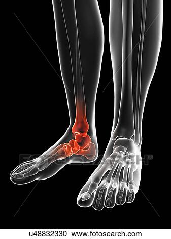 "Human foot pain, Illustration" View Large Illustration Clipart - "Human foot pain, Illustration". Fotosearch