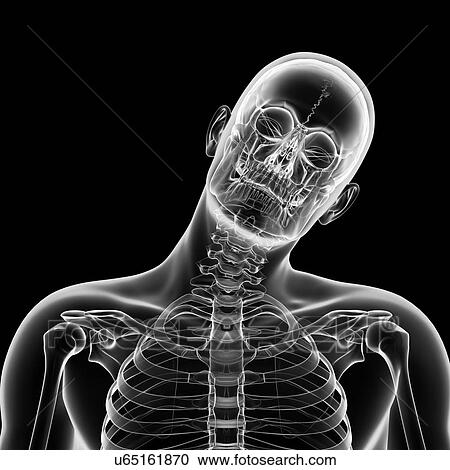 Clipart - "Human head bending sideways, Illustration". Fotosearch