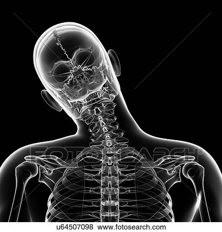 "Human head bending sideways, Illustration" View Large Illustration Stock Illustration - "Human head bending sideways, Illustration". Fotosearch