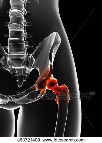 "Human hip pain, Illustration" View Large Illustration Stock Illustration - "Human hip pain, Illustration". Fotosearch