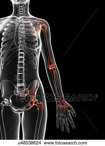"Human joint pain, Illustration" View Large Illustration Stock Illustration - "Human joint pain, Illustration". Fotosearch