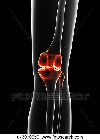 "Human knee pain, Illustration" View Large Illustration Clipart - "Human knee pain, Illustration". Fotosearch