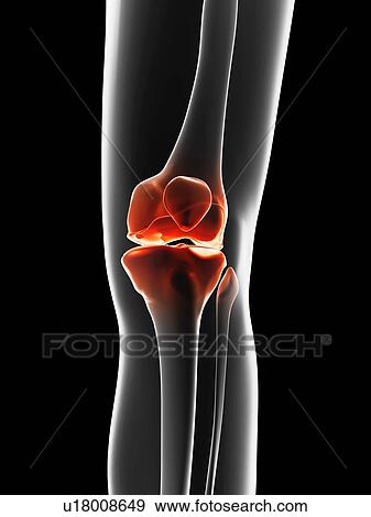 "Human knee pain, Illustration" View Large Illustration Stock Illustration - "Human knee pain, Illustration". Fotosearch