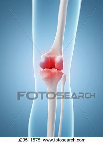 "Human knee pain, Illustration" View Large Illustration Stock Illustration - "Human knee pain, Illustration". Fotosearch
