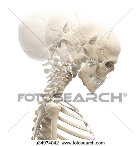 Drawing - "Human neck bending, Illustration". Fotosearch