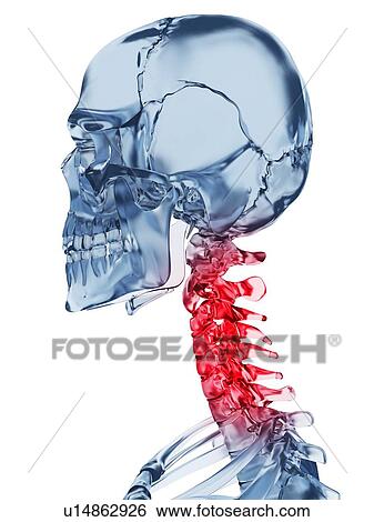 "Human neck pain, Illustration" View Large Illustration Stock Illustration - "Human neck pain, Illustration". Fotosearch