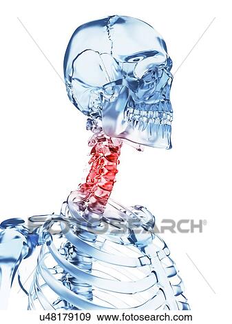 "Human neck pain, Illustration" View Large Illustration Stock Illustration - "Human neck pain, Illustration". Fotosearch