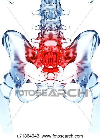 "Human sacrum pain, Illustration" View Large Illustration Drawing - "Human sacrum pain, Illustration". Fotosearch