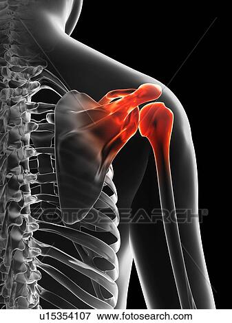 Stock Illustration - "Human shoulder pain, Illustration". Fotosearch