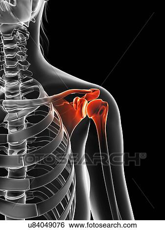 Stock Illustration - "Human shoulder pain, Illustration". Fotosearch