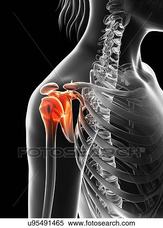 "Human shoulder pain, Illustration" View Large Illustration Stock Illustration - "Human shoulder pain, Illustration". Fotosearch