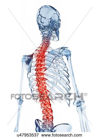Stock Illustration - "Human spine pain, Illustration". Fotosearch