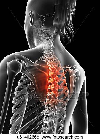 "Human thoracic spine pain, Illustration" View Large Illustration Stock Illustration - "Human thoracic spine pain, Illustration". Fotosearch
