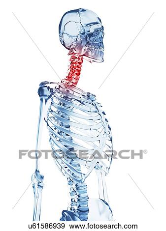 "Neck pain, Illustration" View Large Illustration Stock Illustration - "Neck pain, Illustration". Fotosearch
