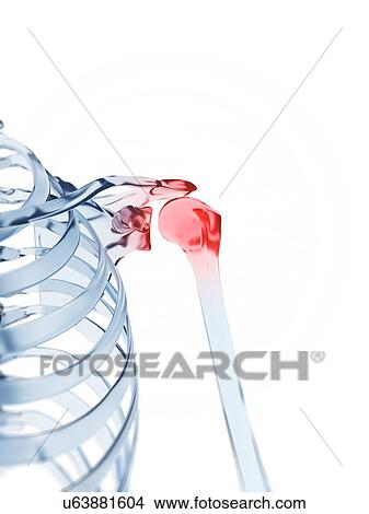 "Shoulder pain, Illustration" View Large Illustration Stock Illustration - "Shoulder pain, Illustration". Fotosearch
