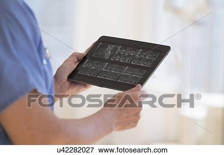 Stock Photo - Man in scrubs watching ultrasound results on tablet. Fotosearch