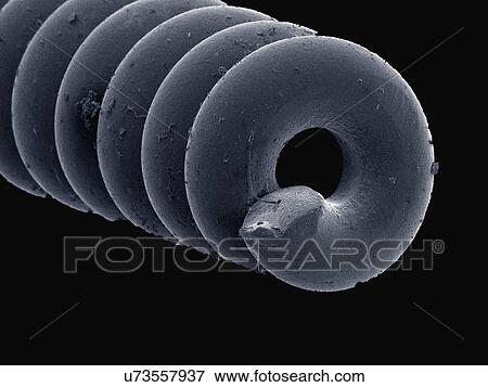 Coloured SEM of acupuncture needle View Large Photo Image Stock Photo - Coloured SEM of acupuncture needle. Fotosearch
