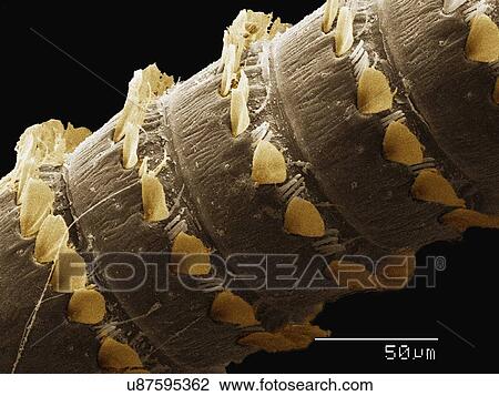 Coloured SEM of antenna of Plecoptera (Peltoperlidae) View Large Photo Image Stock Image - Coloured SEM of antenna of Plecoptera (Peltoperlidae). Fotosearch