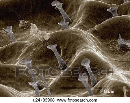 Stock Photo - Coloured SEM of body surface of dobsonfly (Corydalidae). Fotosearch