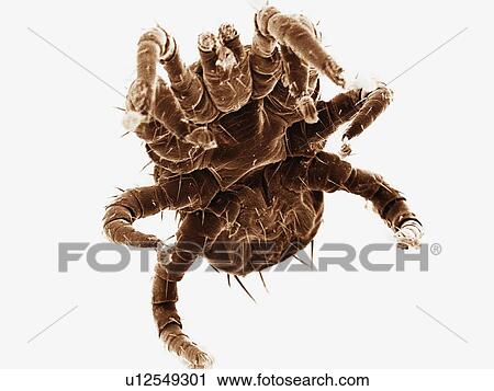 Stock Image - Coloured SEM of ectoparasitic mite collected from bat. Fotosearch