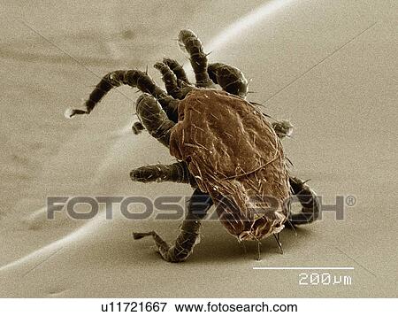 Stock Photo - Coloured SEM of ectoparasitic mite collected from bat. Fotosearch