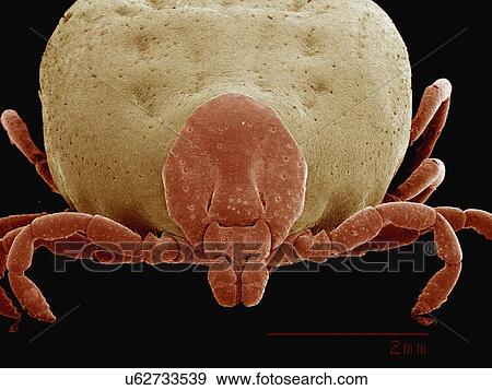 Coloured SEM of engorged female dog tick View Large Photo Image Stock Photo - Coloured SEM of engorged female dog tick. Fotosearch