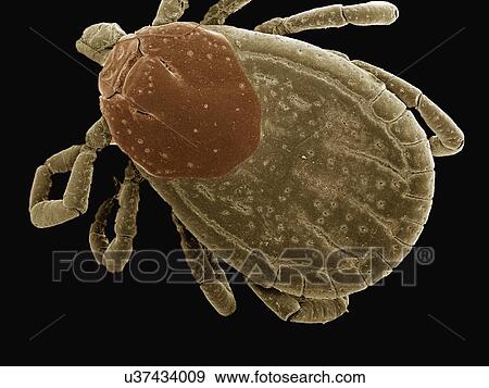 Coloured SEM of female dog tick View Large Photo Image Stock Photo - Coloured SEM of female dog tick. Fotosearch